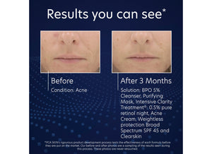 BPO 5% Cleanser