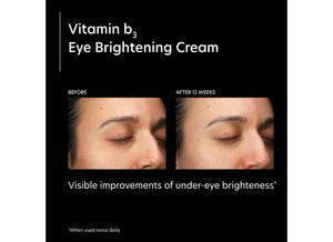 Vitamin b3 Eye Brightening Cream