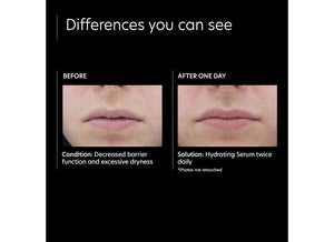 Hydrating Serum